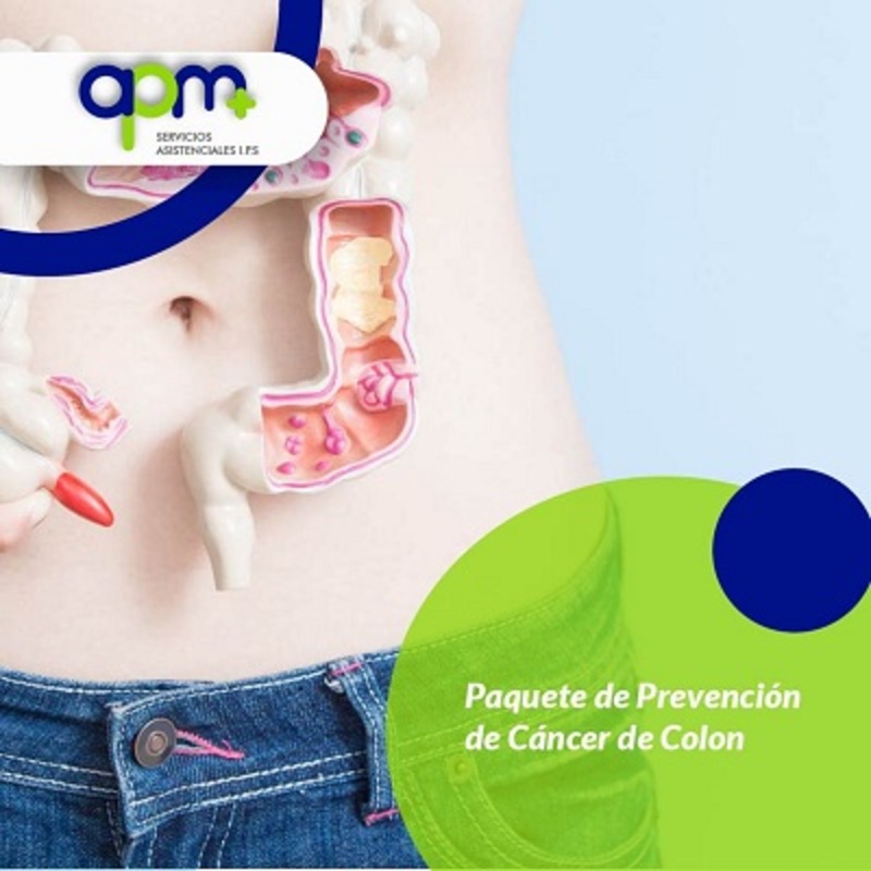 Cáncer de Colon